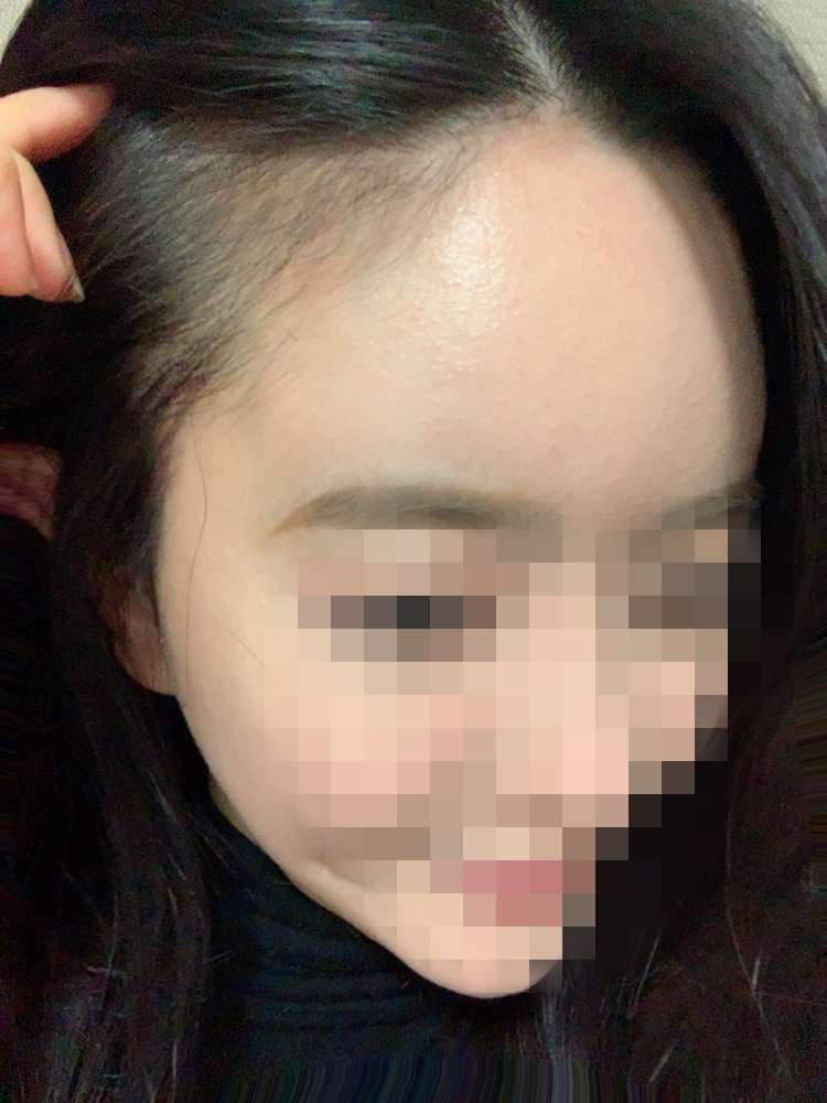 01.이윤주 수술3달.jpg
