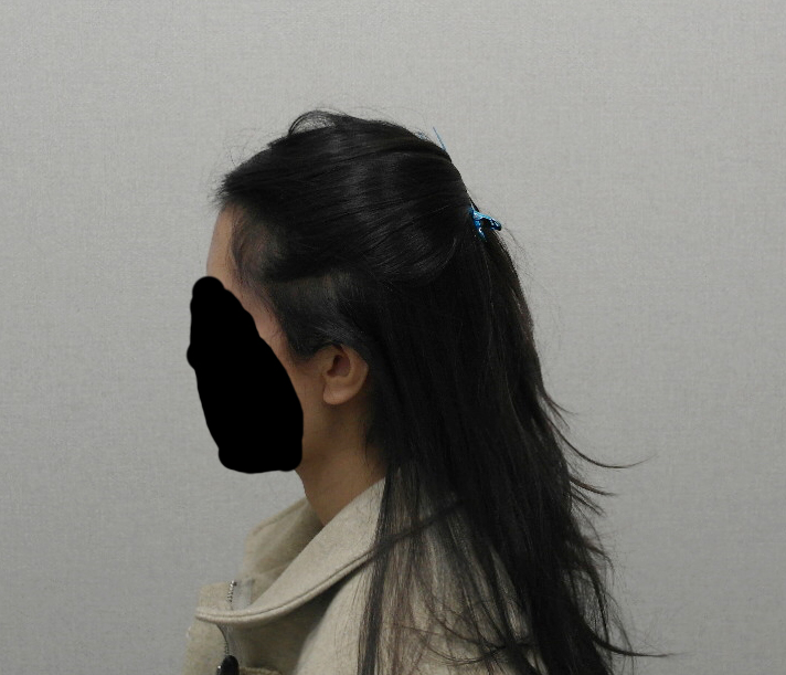 5. 최근 경과보러 가서 찍은 사진.JPG