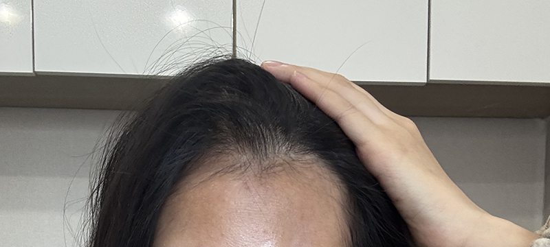 7. 최근 정면.jpg