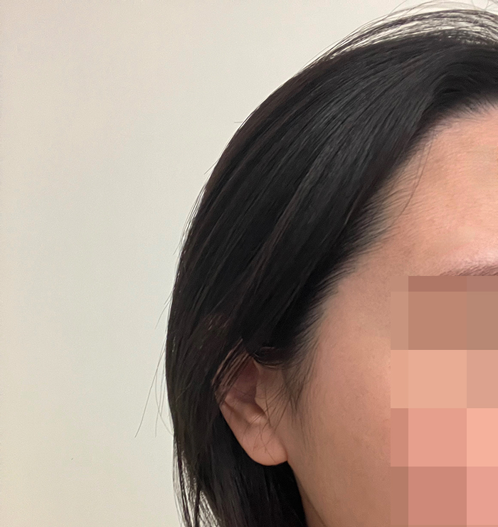 6 최근 측면.jpg
