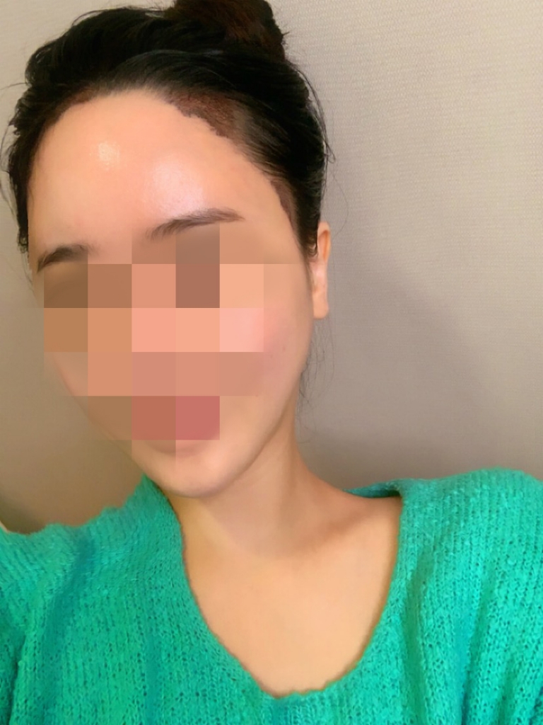 수술+1_04.jpg