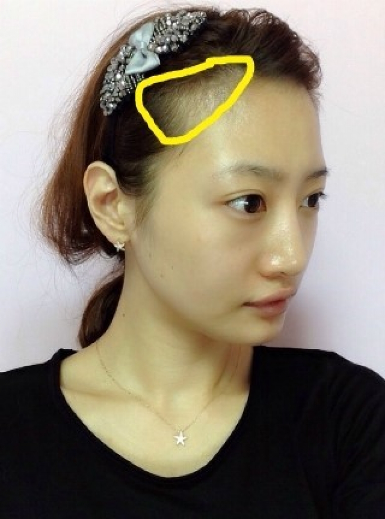 김은영 수술전 2.jpg