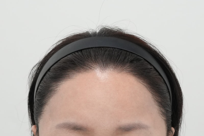 후1.jpg