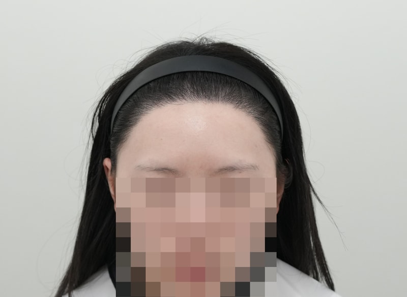 후1.jpg