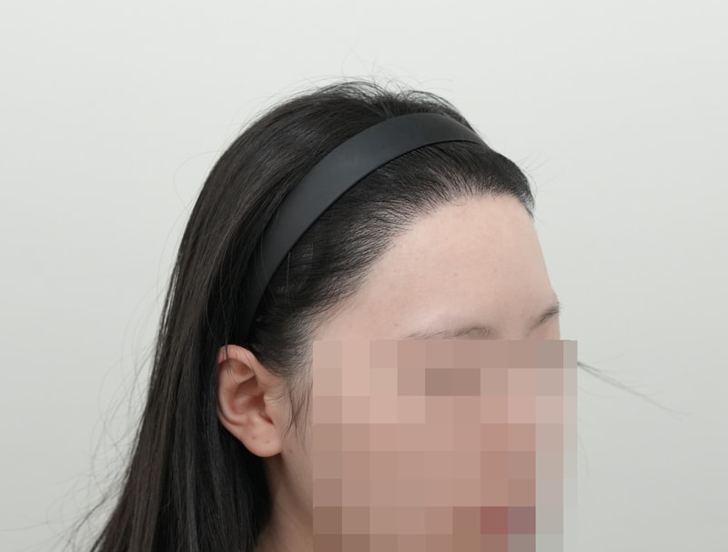 후2.jpg