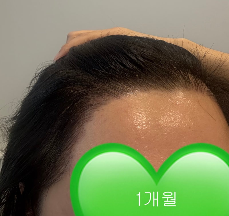 KakaoTalk_20250811_171130189_01.jpg