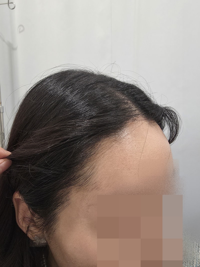 1년경과 (2).jpg