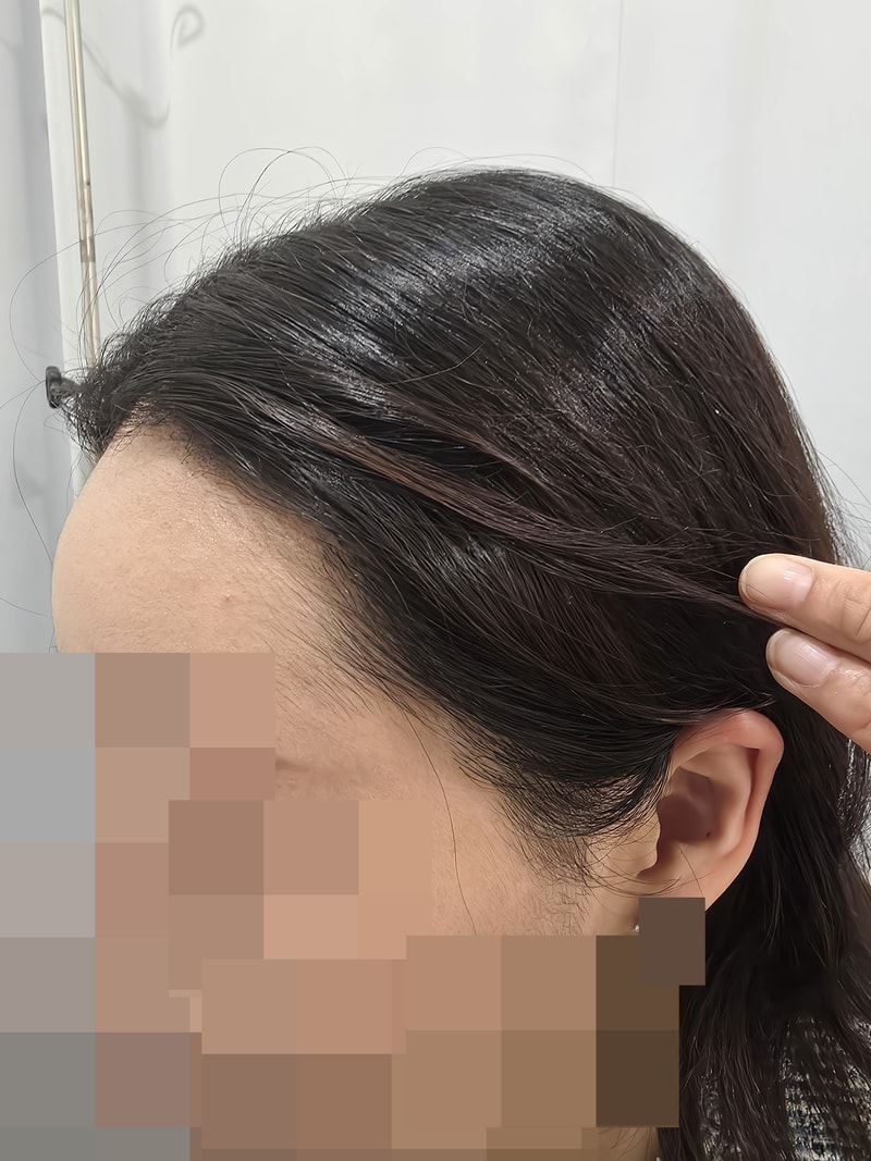 1년경과 (5).jpg