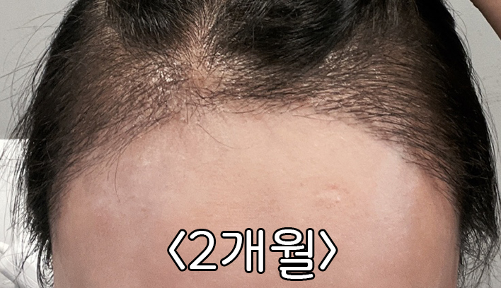 KakaoTalk_2024ㅇ0612_170017060_045.jpg