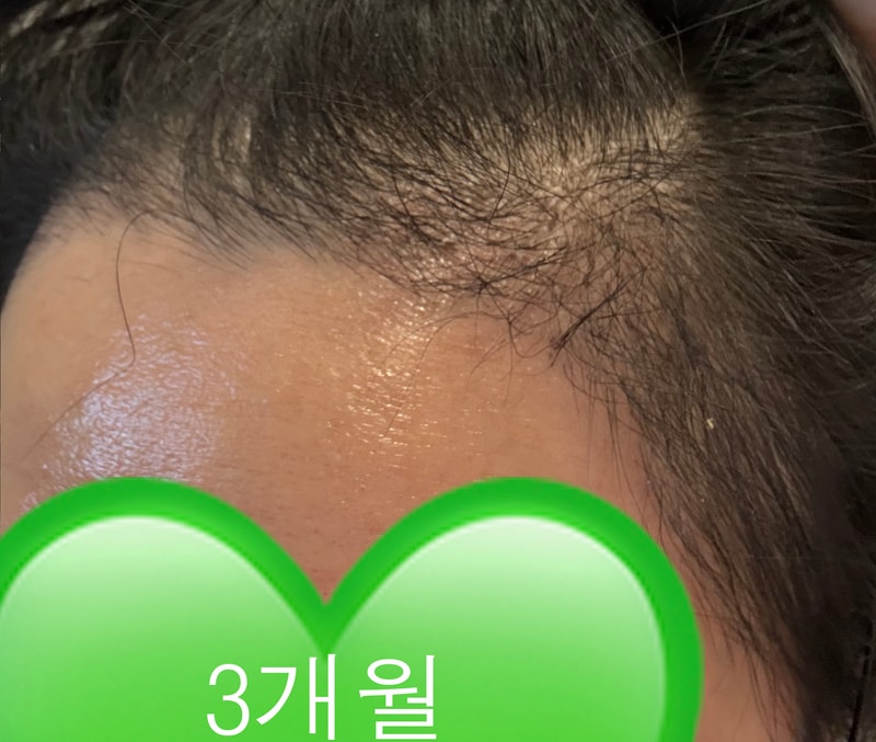 KakaoTalk_20251210_1244467187.jpg