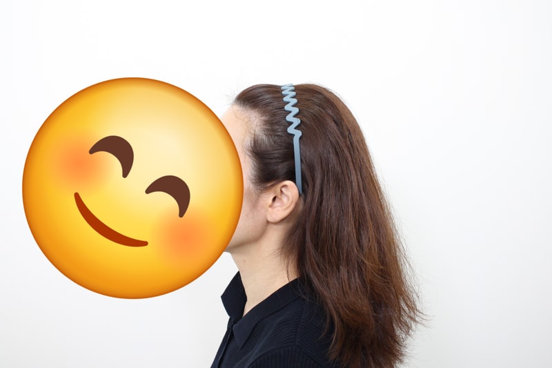 신사역,모프로의원,문건학원장님, 헤어라인+구렛나루, 1년 1개월 최종 경과 후기