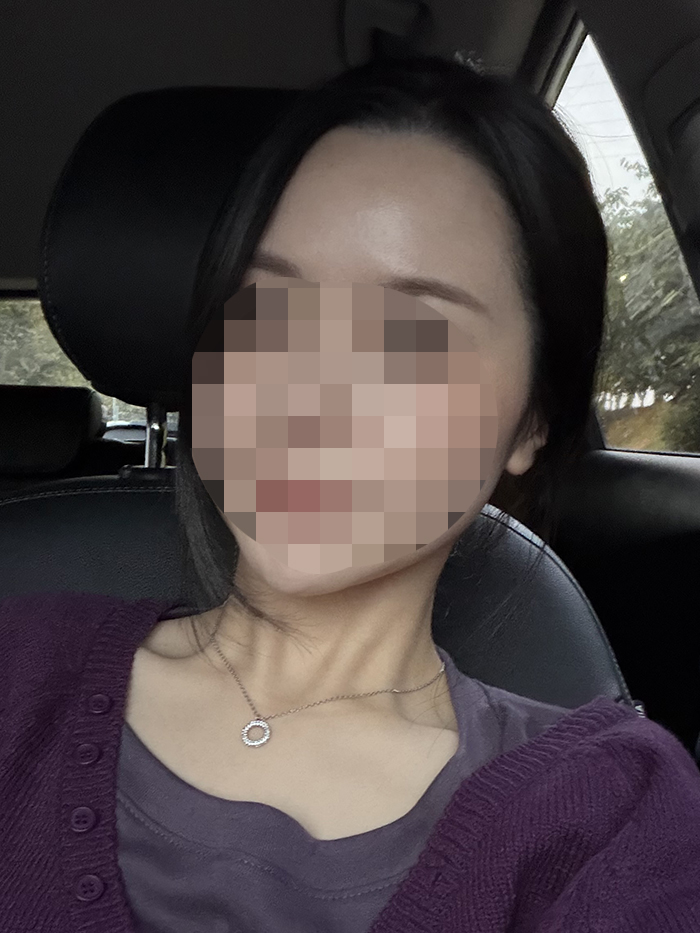 01.수술3년 8개월.jpg