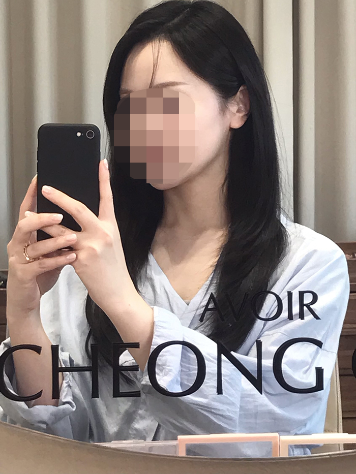 04.수술3년 8개월.jpg