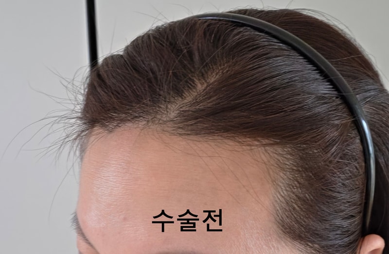 0BKakaoTalk_20260619_155144679_05 65(3).jpg
