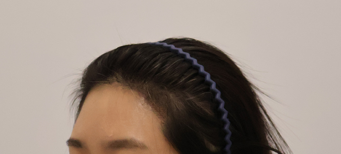 03.수술2주차.JPG