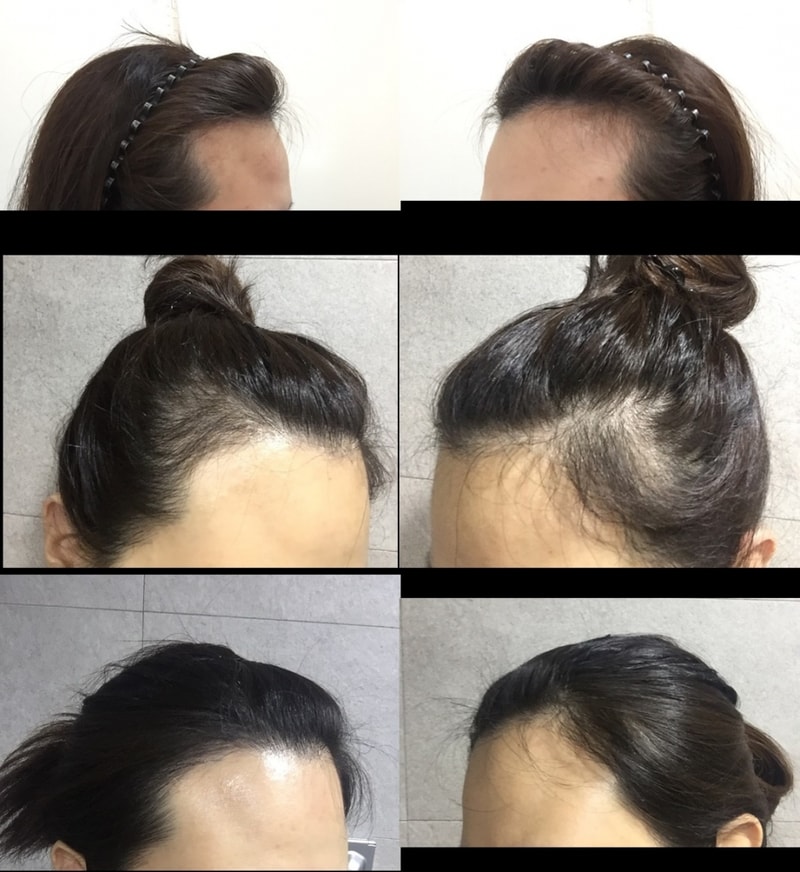 r (7)-tile.jpg