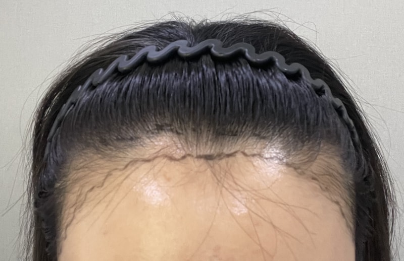 수술 디자인.jpg