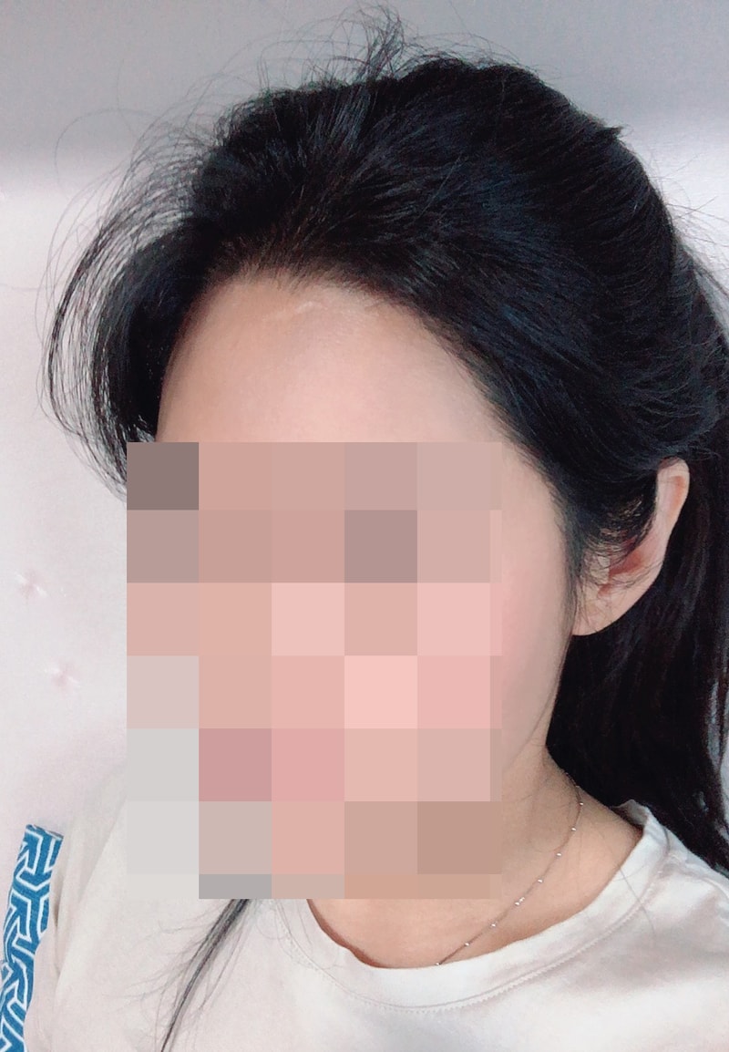 에프터.jpg