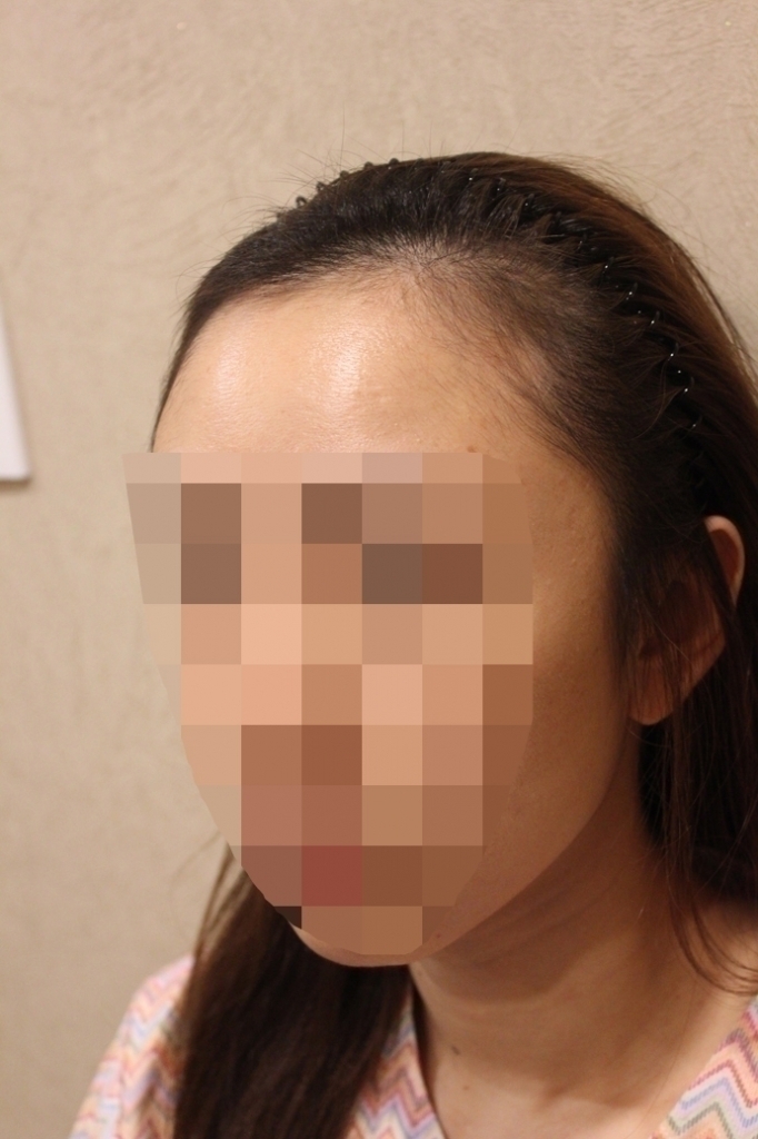 1_before (4).JPG