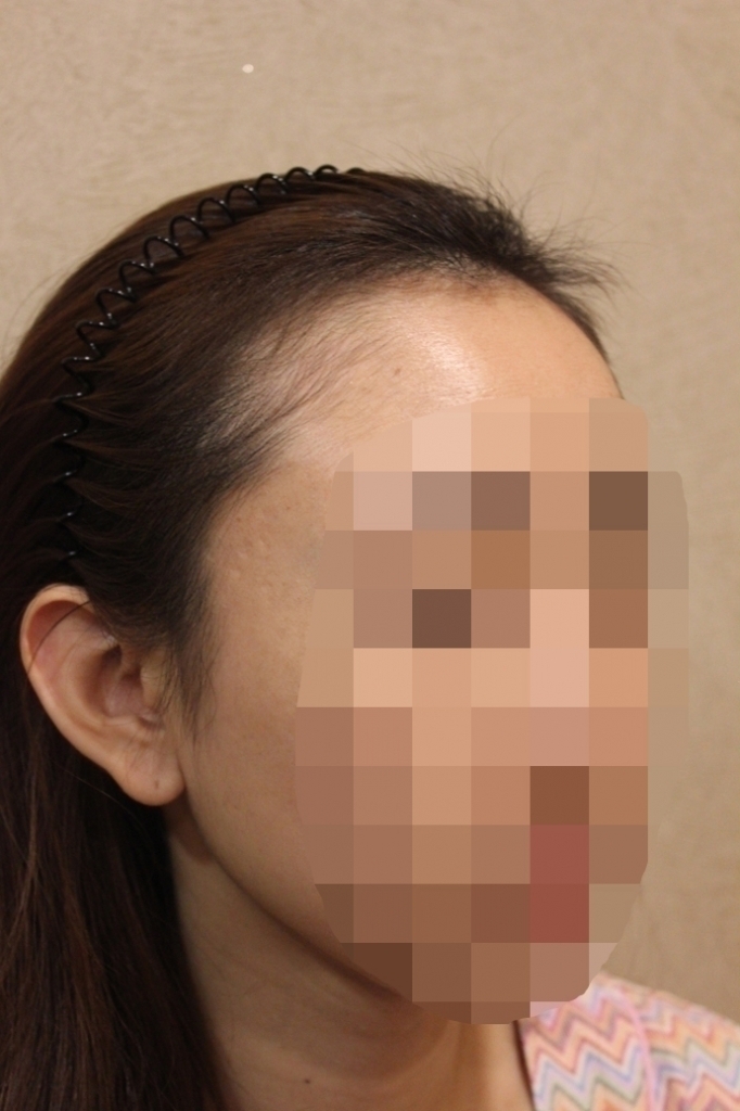 1_before (3).JPG