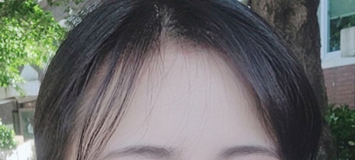 이성경_3개월평상시.jpg