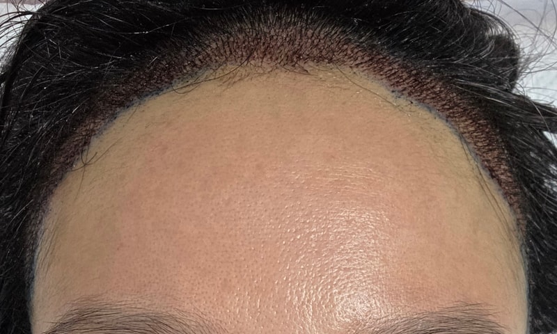 1000021589.jpg