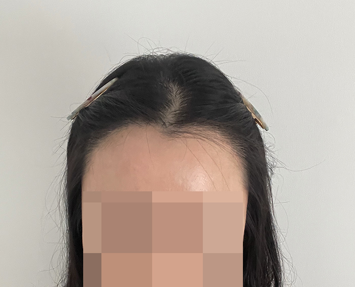 4.최근에 집에서 혼자 찍어봤어요~앞에 더듬이는 제모할까 고민중입니다 ㅠ.jpg