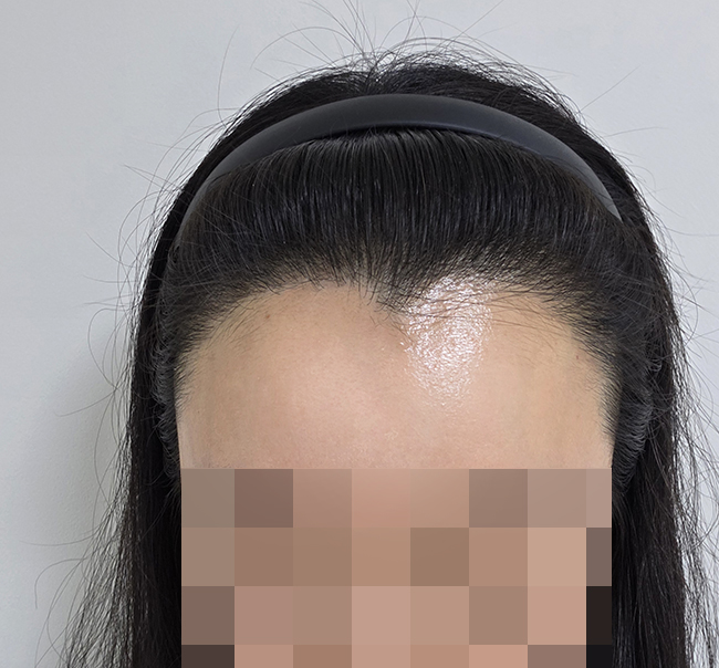 4. 최근정면 사진 찍어봤어요.jpg