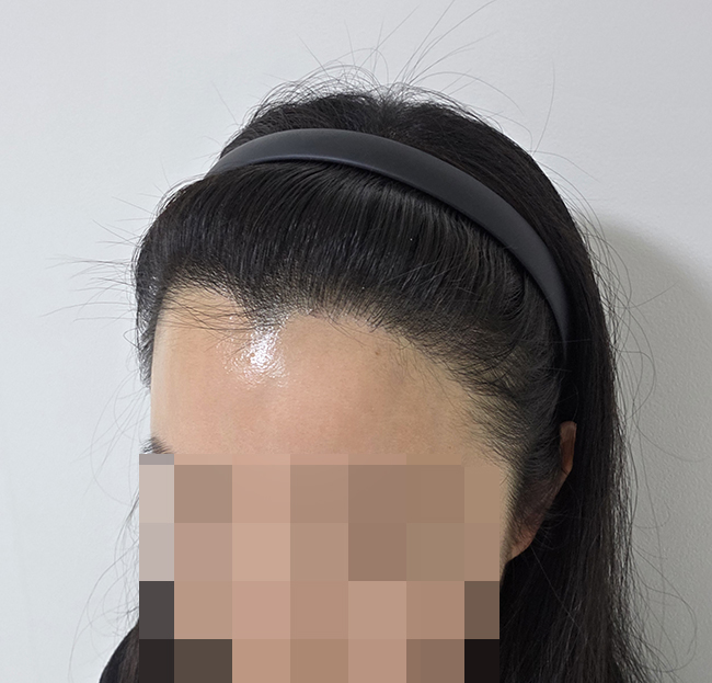 6. 이마 까고 다닐라고 앞머리 열심히 기르고 있어요.jpg
