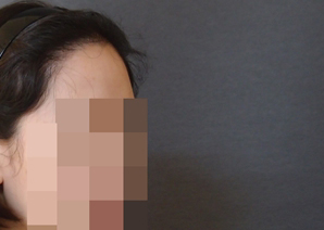 후1.jpg