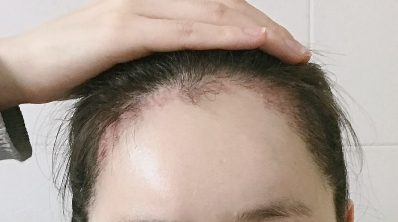KakaoTalk_20180219_174119604.jpg