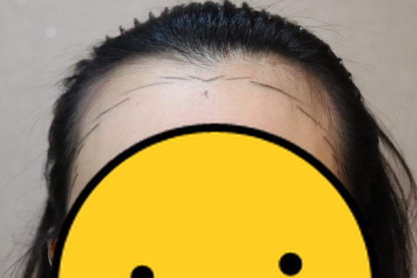 101.jpg