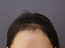 5개월 정면.jpg
