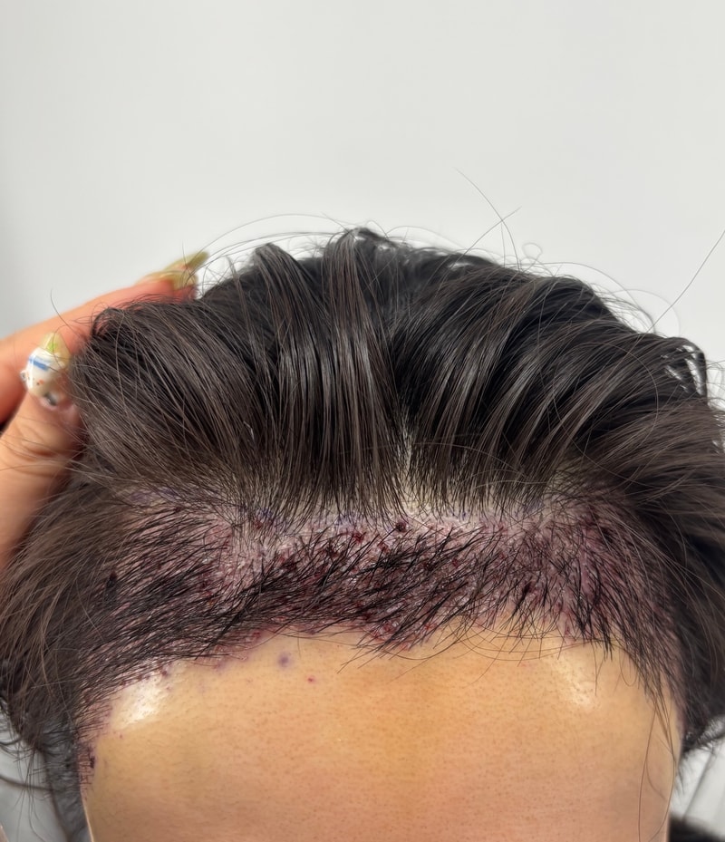 hair1-1.jpeg