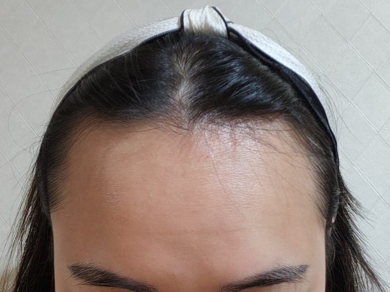 비포 1.jpg