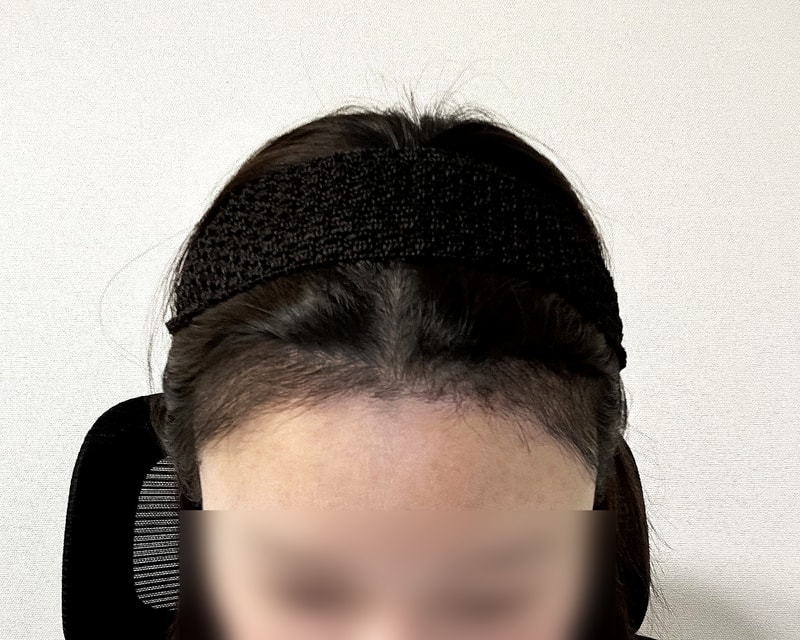1개월차 1.jpg