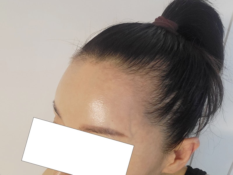 비포 3.jpg