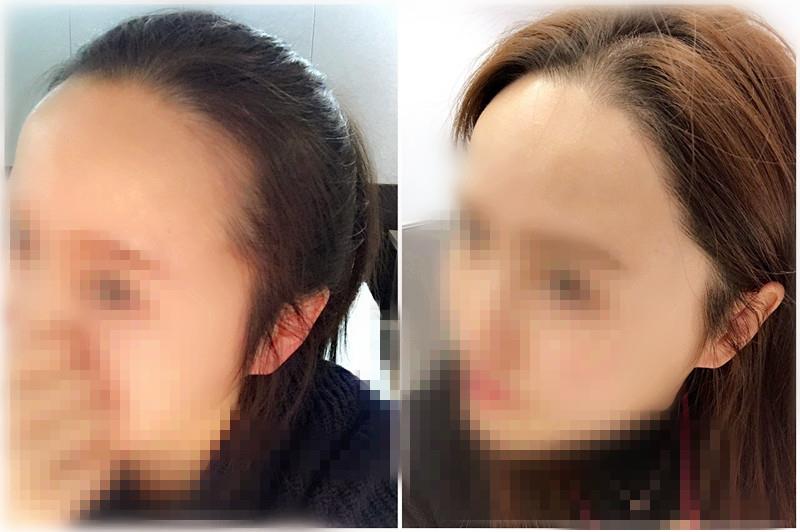 KakaoTalk_20170425_113528755.jpg