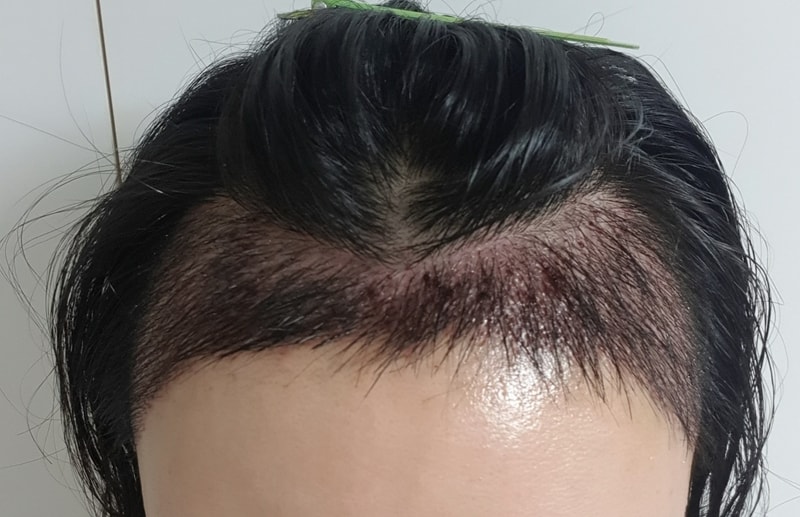 정면상위2일차.jpg