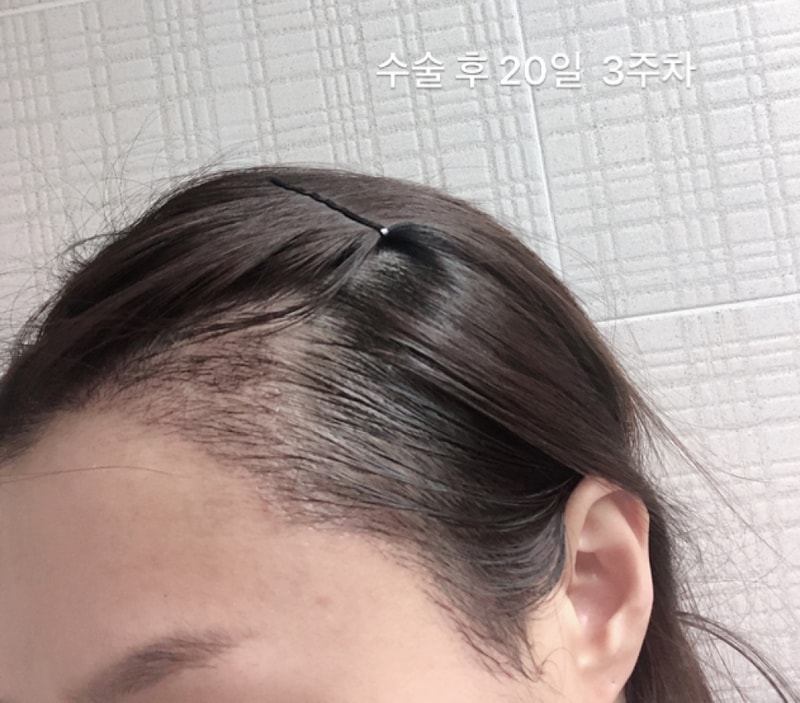 62D2E1E7-C6C0-436C-A76A-0C3D3BCE9881.png