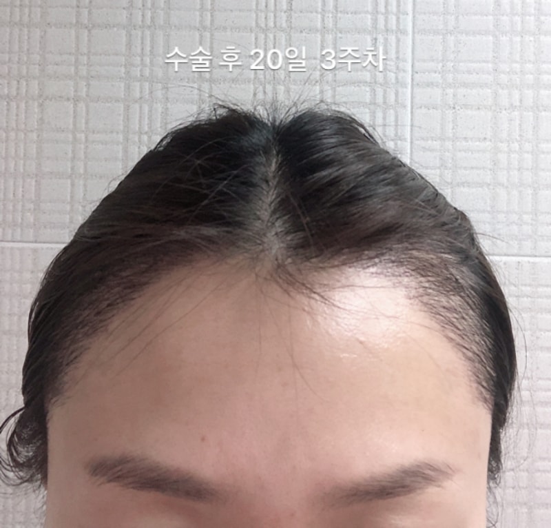ABCA246F-5A9D-49B7-9629-B10A4E8C5265.png