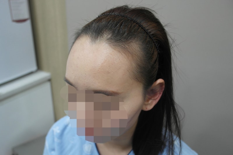7개월 (8).JPG