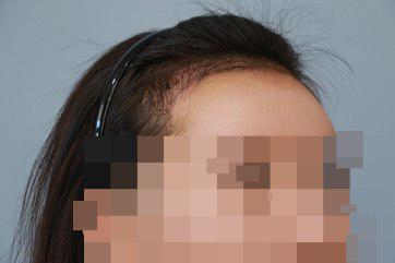 무궁화꽃 (2).jpg