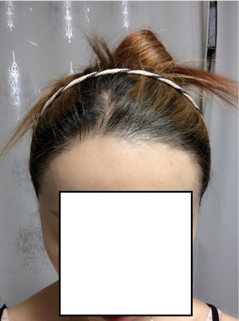 KakaoTalk_20150106_152541907.jpg