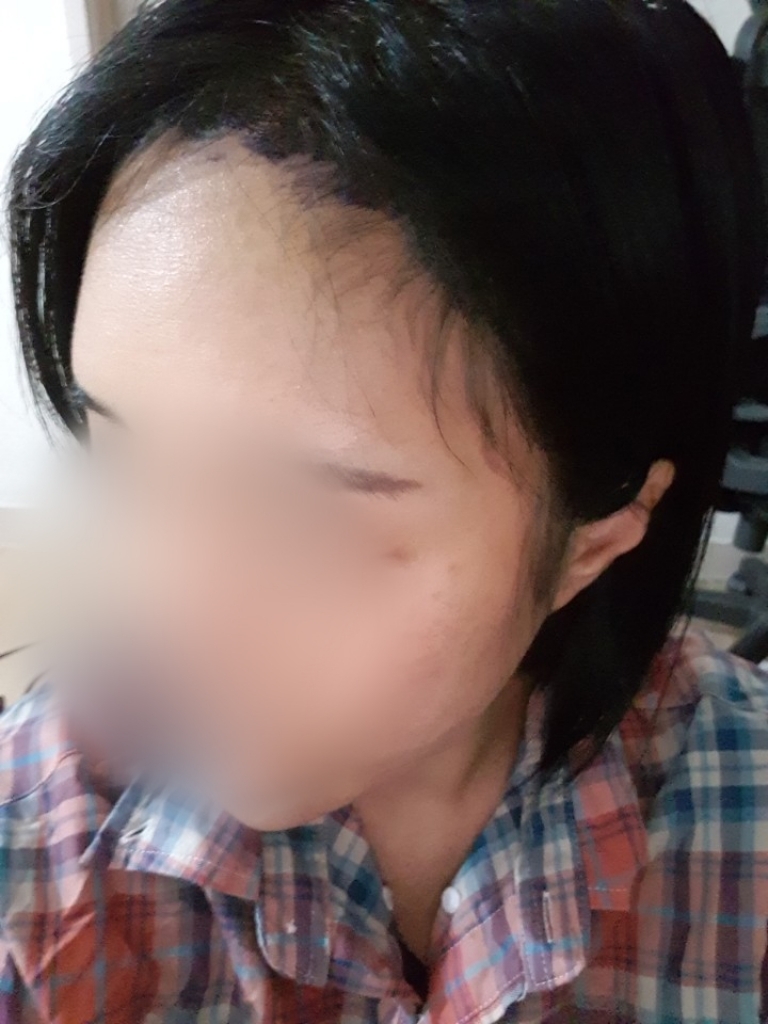 12.수술1일2.jpg