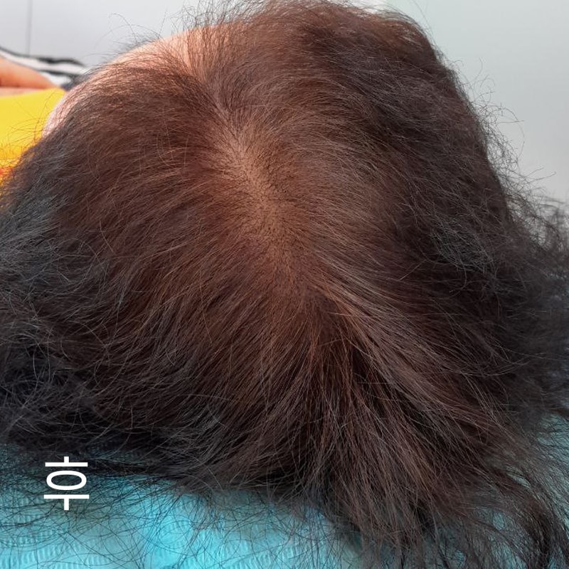 임형남 1차후21.jpg