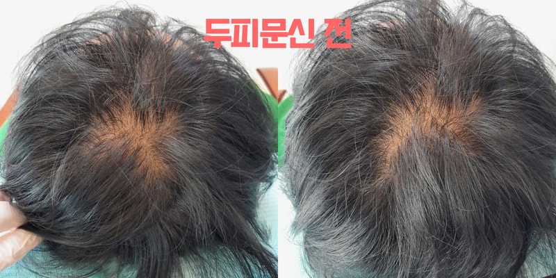 이철중 1차전.jpg