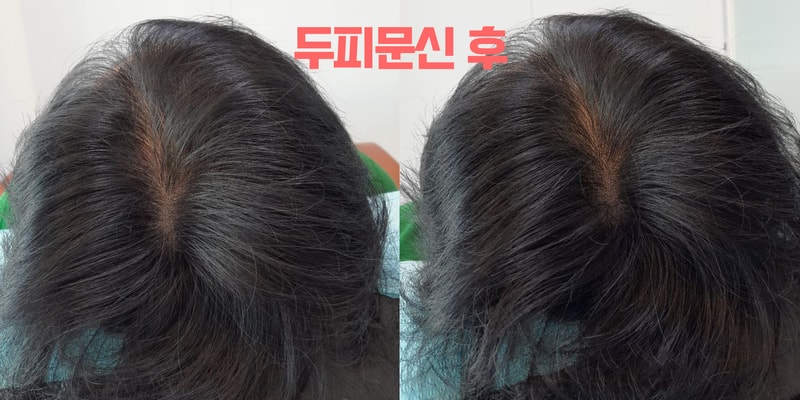 이철중 1차후.jpg