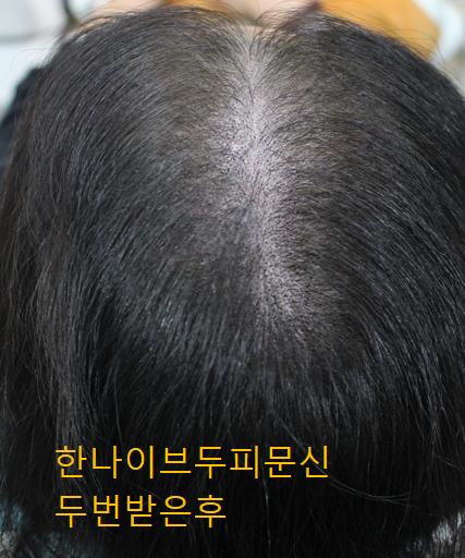 후.png