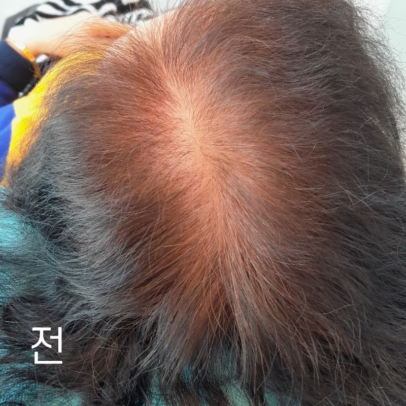 임형남 1차전11.jpg